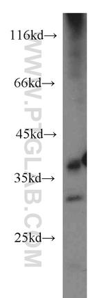 MRPL3 Antibody in Western Blot (WB)