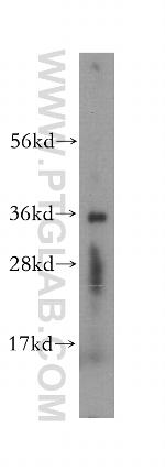 SDR39U1 Antibody in Western Blot (WB)