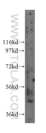 NUPL2 Antibody in Western Blot (WB)