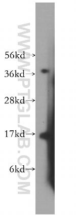 MED31 Antibody in Western Blot (WB)