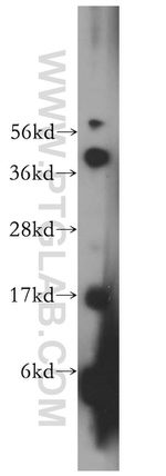 MED31 Antibody in Western Blot (WB)
