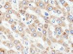ACSM5 Antibody in Immunohistochemistry (Paraffin) (IHC (P))