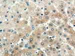 SDS Antibody in Immunohistochemistry (Paraffin) (IHC (P))