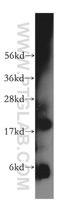 ZNHIT1 Antibody in Western Blot (WB)