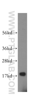 ZNHIT1 Antibody in Western Blot (WB)