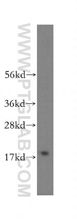 ZNHIT1 Antibody in Western Blot (WB)