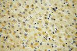 SMAP2 Antibody in Immunohistochemistry (Paraffin) (IHC (P))