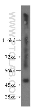 SMAP2 Antibody in Western Blot (WB)