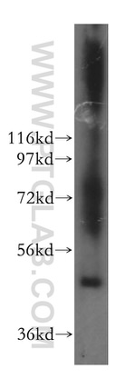SMAP2 Antibody in Western Blot (WB)