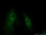 HEXIM2 Antibody in Immunocytochemistry (ICC/IF)