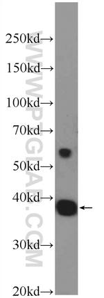 HEXIM2 Antibody in Western Blot (WB)