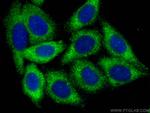 SPTLC3 Antibody in Immunocytochemistry (ICC/IF)