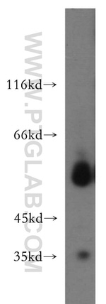 LIPH Antibody in Western Blot (WB)