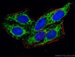 TFB1M Antibody in Immunocytochemistry (ICC/IF)