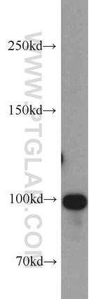 OTUD7B Antibody in Western Blot (WB)