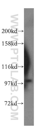 OTUD7B Antibody in Western Blot (WB)
