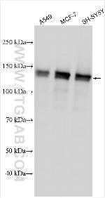 FTSJ3 Antibody in Western Blot (WB)