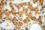 MRPL46 Antibody in Immunohistochemistry (Paraffin) (IHC (P))
