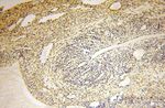 CDKN2AIP Antibody in Immunohistochemistry (Paraffin) (IHC (P))