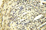 CDKN2AIP Antibody in Immunohistochemistry (Paraffin) (IHC (P))