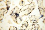 CDKN2AIP Antibody in Immunohistochemistry (Paraffin) (IHC (P))