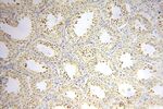 CDKN2AIP Antibody in Immunohistochemistry (Paraffin) (IHC (P))