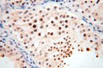 CDKN2AIP Antibody in Immunohistochemistry (Paraffin) (IHC (P))