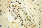 CDKN2AIP Antibody in Immunohistochemistry (Paraffin) (IHC (P))