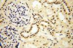 CDKN2AIP Antibody in Immunohistochemistry (Paraffin) (IHC (P))