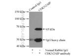 CDKN2AIP Antibody in Immunoprecipitation (IP)