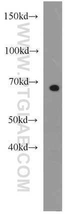 CDKN2AIP Antibody in Western Blot (WB)
