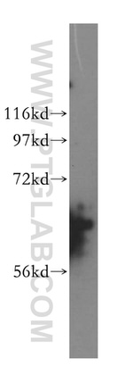 CDKN2AIP Antibody in Western Blot (WB)