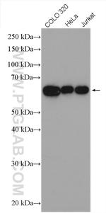 CDKN2AIP Antibody in Western Blot (WB)