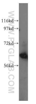 CDKN2AIP Antibody in Western Blot (WB)