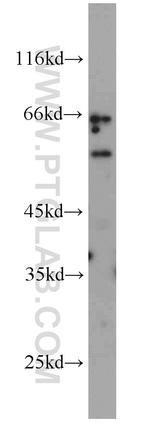 LAG-3 Antibody in Western Blot (WB)