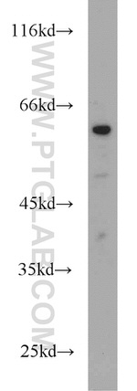 LAG-3 Antibody in Western Blot (WB)