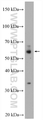 LAG-3 Antibody in Western Blot (WB)