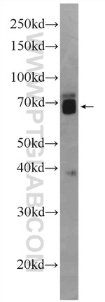 ZNF143 Antibody in Western Blot (WB)