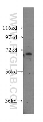 ZNF143 Antibody in Western Blot (WB)