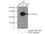 INTS3 Antibody in Immunoprecipitation (IP)