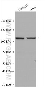 INTS3 Antibody in Western Blot (WB)