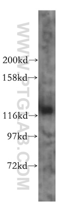 INTS3 Antibody in Western Blot (WB)