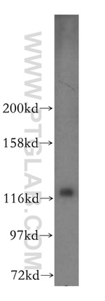INTS3 Antibody in Western Blot (WB)