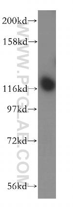 INTS3 Antibody in Western Blot (WB)
