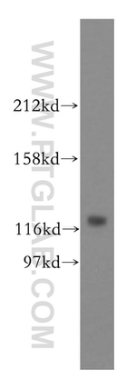 INTS3 Antibody in Western Blot (WB)