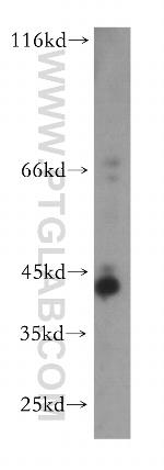 TMLHE Antibody in Western Blot (WB)
