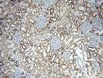 ACADS Antibody in Immunohistochemistry (Paraffin) (IHC (P))