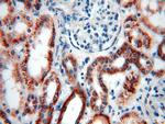 ACADS Antibody in Immunohistochemistry (Paraffin) (IHC (P))
