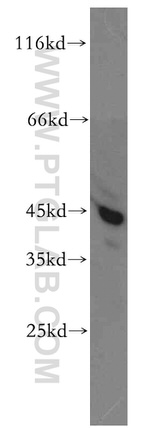 ACADS Antibody in Western Blot (WB)