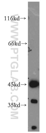 ACADS Antibody in Western Blot (WB)